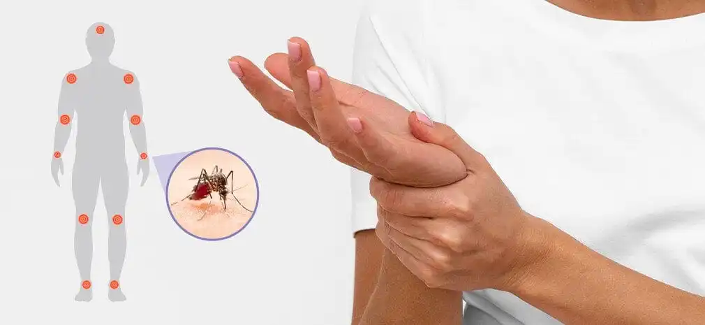 Tratamento de Chikungunya: Como tratar as dores articulares crônicas