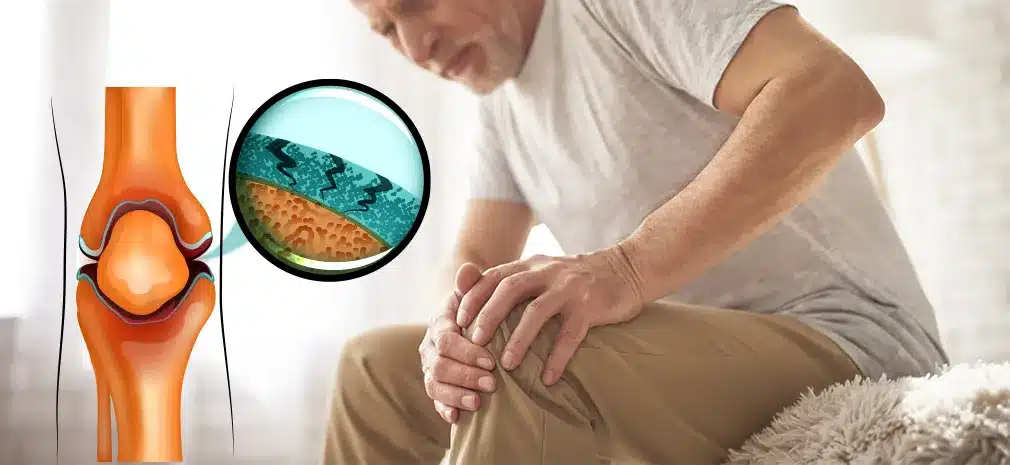 idoso-com-rigidez-matinal-e-dor-no-joelho Idoso sentado na cama segurando o joelho com expressão de dor, ilustrando rigidez matinal e desgaste articular por osteoartrite.