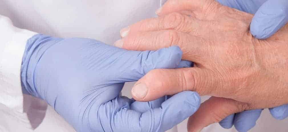 Médica reumatologista usando luvas azuis realiza exame físico clínico nas articulações das mãos de um paciente com sintomas de artrite reumatóide, representando o diagnóstico e tratamento da doença em Uberaba e por telemedicina.